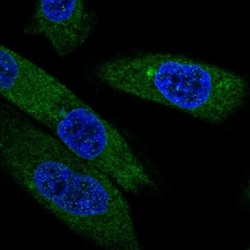EBPL Antibody, Novus Biologicals:Antibodies:Primary Antibodies